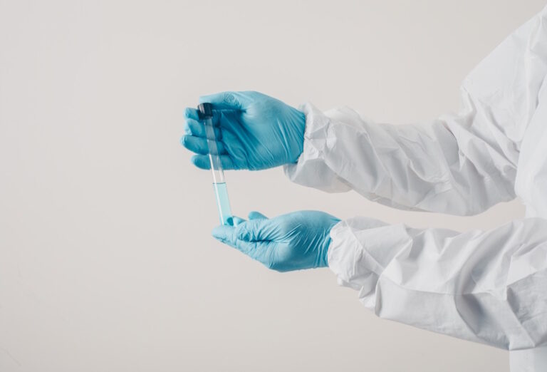 Chemical-Gloves-Summitech-Anti-Kimia-untuk-Pekerja-Laboratorium-1-Griya-Safety
