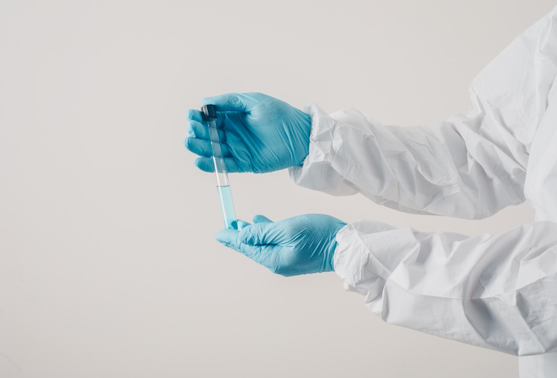 Chemical-Gloves-Summitech-Anti-Kimia-untuk-Pekerja-Laboratorium-1-Griya-Safety